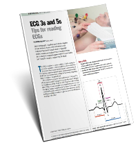ECG 3s and 5s -Tips for reading ECGs Free Teaching Article for Nurses and Students