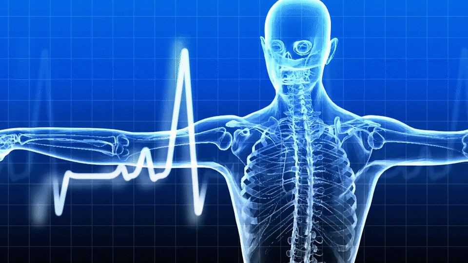 Virtual Heart Scan Consultation (Includes CT Scan Cost + Referral, Report of Scan, Interpretation Guide  + eBook & audiobook: Know Your Risk of Heart Attack Package valued at $20)